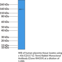 c-Kit/CD117 (C-Term) Rabbit Monoclonal Antibody