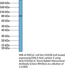 ALK/CD246 (C-Term) Rabbit Monoclonal Antibody