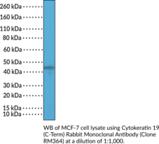 Cytokeratin 19 (C-Term) Rabbit Monoclonal Antibody