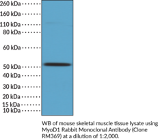 MyoD1 Rabbit Monoclonal Antibody