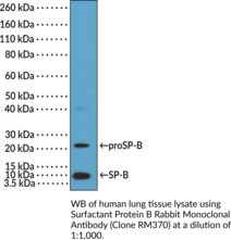 Surfactant Protein B Rabbit Monoclonal Antibody