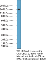 CR2/CD21 (C-Term) Rabbit Monoclonal Antibody