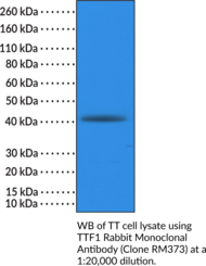 TTF1 Rabbit Monoclonal Antibody