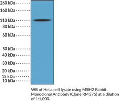 MSH2 Rabbit Monoclonal Antibody