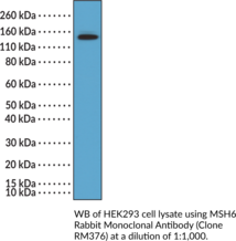 MSH6 Rabbit Monoclonal Antibody