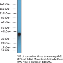 ARG1 (C-Term) Rabbit Monoclonal Antibody