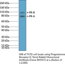 Progesterone Receptor (C-Term) Rabbit Monoclonal Antibody