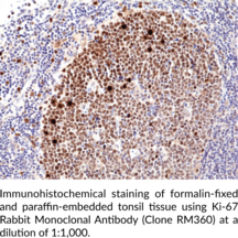 Ki-67 Rabbit Monoclonal Antibody