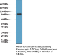 Chromogranin A (N-Term) Rabbit Monoclonal Antibody