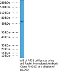 p63 Rabbit Monoclonal Antibody