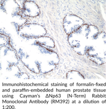 ΔNp63 (N-Term) Rabbit Monoclonal Antibody