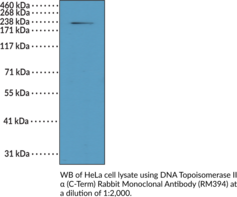 DNA Topoisomerase II? (C-Term) Rabbit Monoclonal Antibody