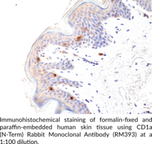 CD1a (N-Term) Rabbit Monoclonal Antibody