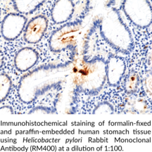 <em>Helicobacter pylori</em> Rabbit Monoclonal Antibody