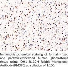 IDH1 R132H Rabbit Monoclonal Antibody