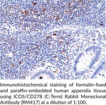 ICOS/CD278 (C-Term) Rabbit Monoclonal Antibody