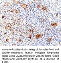 CD25/Interleukin-2R? (N-Term) Rabbit Monoclonal Antibody