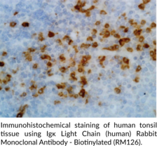 Ig? Light Chain (human) Rabbit Monoclonal Antibody - Biotinylated