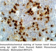 Ig? Light Chain (human) Rabbit Monoclonal Antibody - Biotinylated