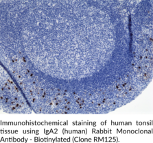 IgA2 (human) Rabbit Monoclonal Antibody - Biotinylated