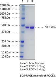 ROCK1 (human, recombinant)