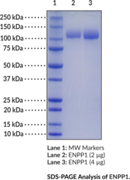 ENPP1 (human, recombinant)