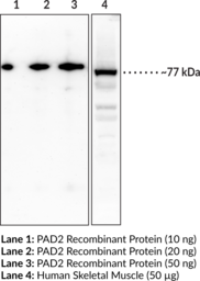 PAD2 Polyclonal Antibody