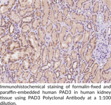 PAD3 Polyclonal Antibody