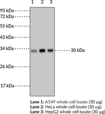 Interleukin-6 Monoclonal Antibody