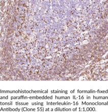 Interleukin-16 Monoclonal Antibody