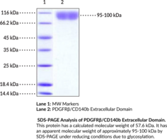 PDGFR?/CD140b Extracellular Domain (human, recombinant)