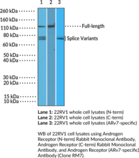 Androgen Receptor (C-Term) Rabbit Monoclonal Antibody