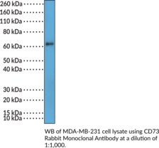 Ecto-5’-<wbr/>nucleotidase/<wbr/>CD73 Rabbit Monoclonal Antibody