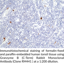 Granzyme B (C-Term) Rabbit Monoclonal Antibody