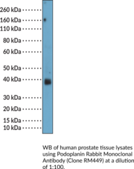 Podoplanin Rabbit Monoclonal Antibody (Clone RM449)