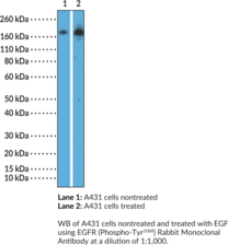 EGFR (Phospho-Tyr<sup>1068</sup>) Rabbit Monoclonal Antibody (Clone RM443)