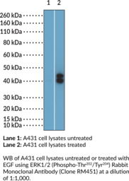 ERK1/2 (Phospho-Thr<sup>202</sup>/Tyr<sup>204</sup>) Rabbit Monoclonal Antibody