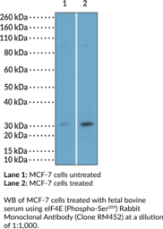 eIF4E (Phospho-Ser<sup>209</sup>) Rabbit Monoclonal Antibody