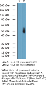 Aurora A (Phospho-Thr<sup>288</sup>)/Aurora B (Phospho-Thr<sup>232</sup>)/Aurora C (Phospho-Thr<sup>198</sup>) Rabbit Monoclonal Antibody