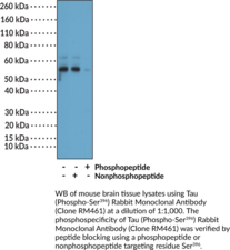 Tau (Phospho-Ser<sup>396</sup>) Rabbit Monoclonal Antibody