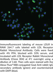 LDL Receptor Rabbit Monoclonal Antibody