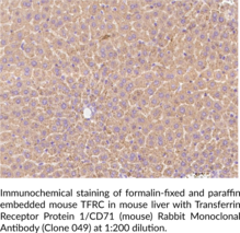 Transferrin Receptor Protein 1/CD71 (mouse) Rabbit Monoclonal Antibody (Clone 049)