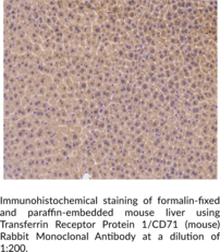 Transferrin Receptor Protein 1/CD71 (mouse) Rabbit Monoclonal Antibody (Clone 179)