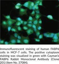 FABP6 Rabbit Monoclonal Antibody (Clone 201)