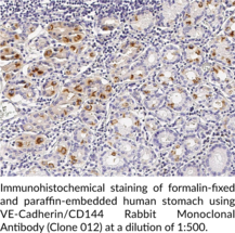 VE-Cadherin/CD144 Rabbit Monoclonal Antibody