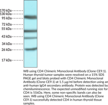 CD4 Chimeric Monoclonal Antibody (Clone CE9.1)