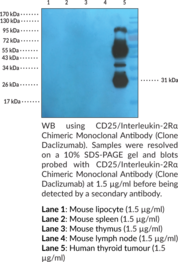 CD25/Interleukin-2R? Chimeric Monoclonal Antibody