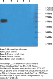 CD25/Interleukin-2R? Chimeric Monoclonal Antibody (aa 116-122)
