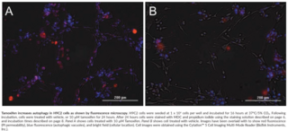 Autophagy/<wbr/>Cytotoxicity Dual Staining Kit