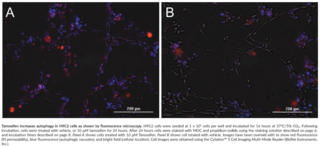 Autophagy/<wbr/>Cytotoxicity Dual Staining Kit